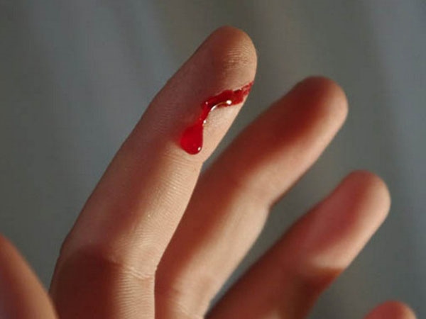 Giải mã bí ẩn nằm mơ thấy đứt tay chảy máu có điềm gì?